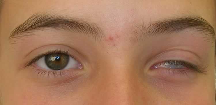 Superior Scleral Cover Shells - Eyes Alive